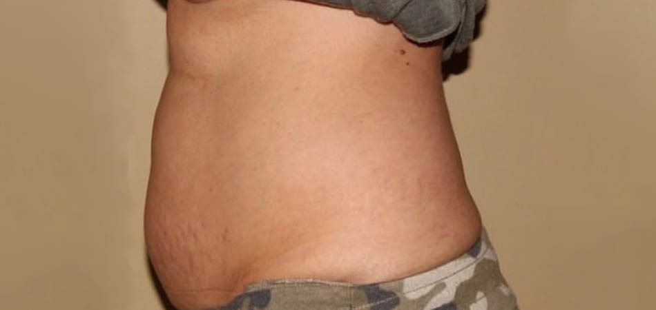Exilis